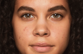 Best Makeup For Acne Prone Skin: Tips & FAQs